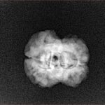 2 Mukhi Rudraksha 20.6mm 1.84gm - Xray