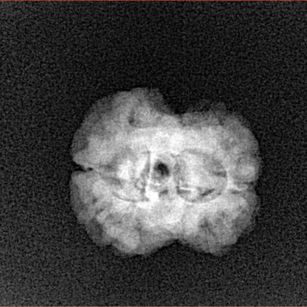 2 Mukhi Rudraksha 20.6mm 1.84gm - Xray