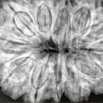 12 Mukhi Rudraksha 36.3mm 9.34gm - Xray