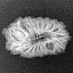 17 Mukhi Rudraksha 22mm 1.79gm - Xray