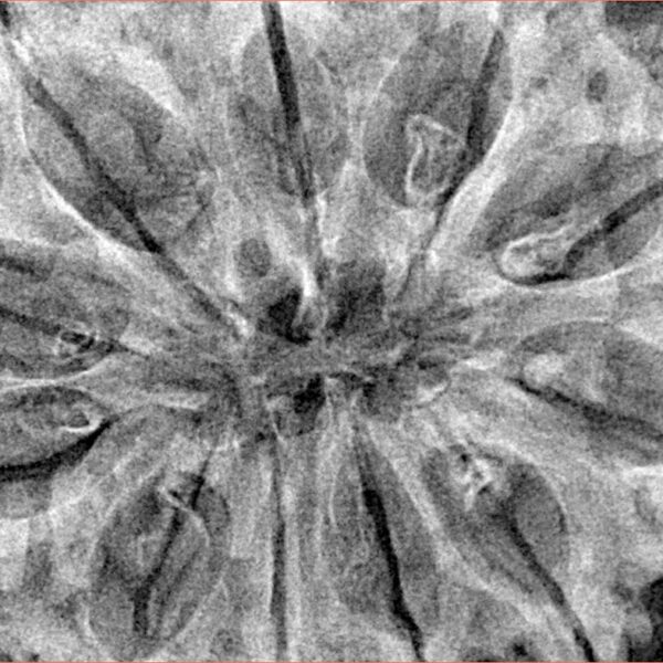 11 Mukhi Rudraksha 38.5mm 9.38gm - Xray