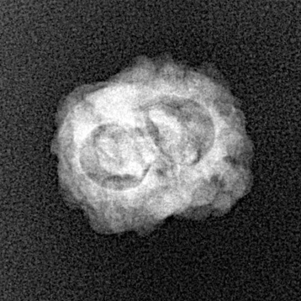 2 Mukhi Rudraksha 20.4mm 1.36gm - Xray