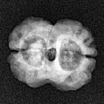 2 Mukhi Rudraksha 20mm 1.55gm - Xray