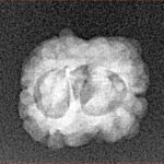 2 Mukhi Rudraksha 18.3mm 1.33gm - Xray
