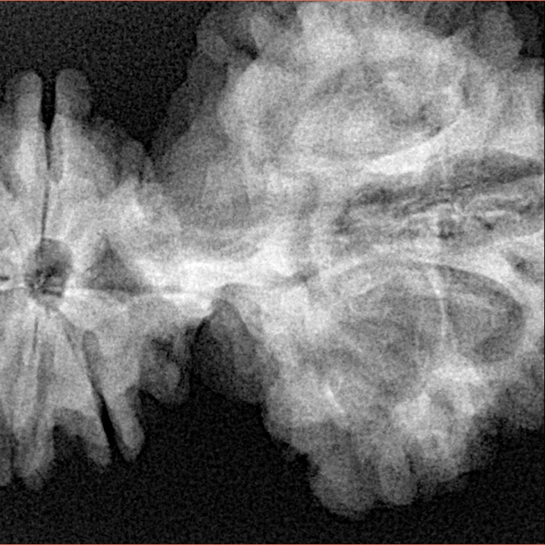 15 Mukhi Trijuti 54.5mm 12.31gm - Xray