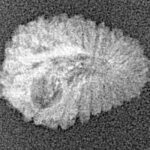 18 Mukhi Rudraksha 16.2mm 0.64gm - Xray