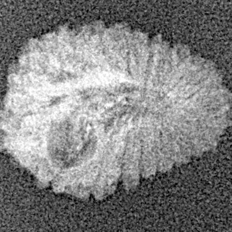 18 Mukhi Rudraksha 16.2mm 0.64gm - Xray