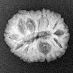16 Mukhi Rudraksha 19.2mm 2.12gm - Xray