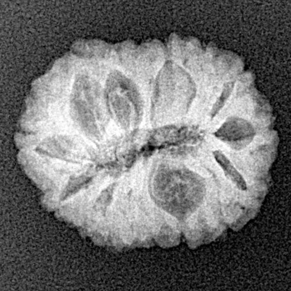 16 Mukhi Rudraksha 19.2mm 2.12gm - Xray