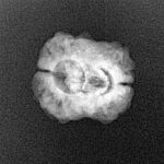 2 Mukhi Rudraksha 21.1mm 1.57gm - Origin: Nepal - Xray
