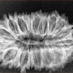 21 Mukhi Rudraksha 30.8mm 4.1gm - Xray