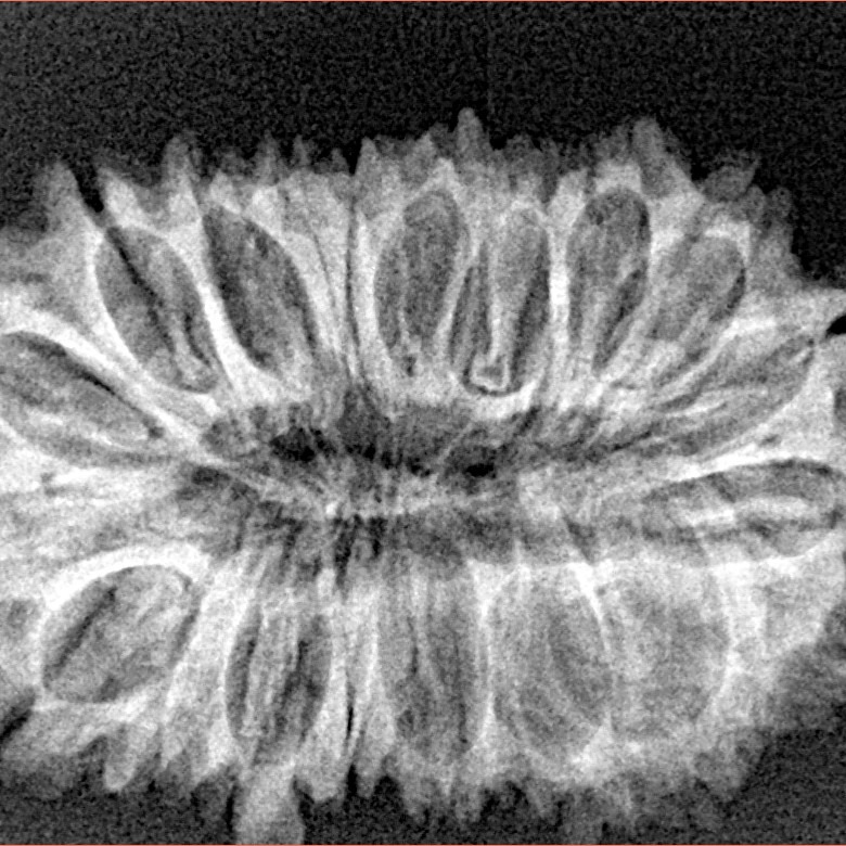 21 Mukhi Rudraksha 30.8mm 4.1gm - Xray