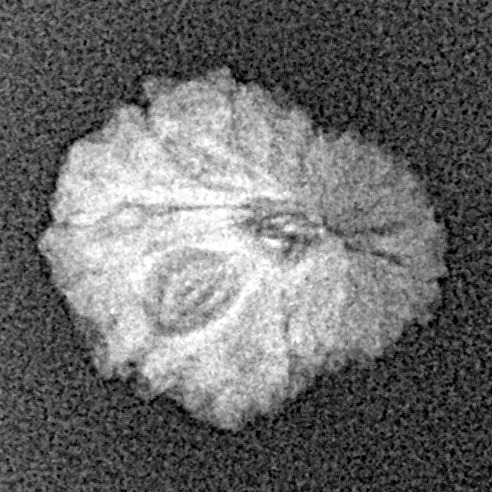 16 Mukhi Rudraksha 13.6mm 0.7gm - Xray