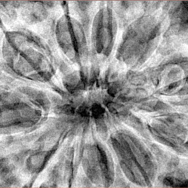 11 Mukhi Rudraksha 38.6mm 9.63gm - Xray