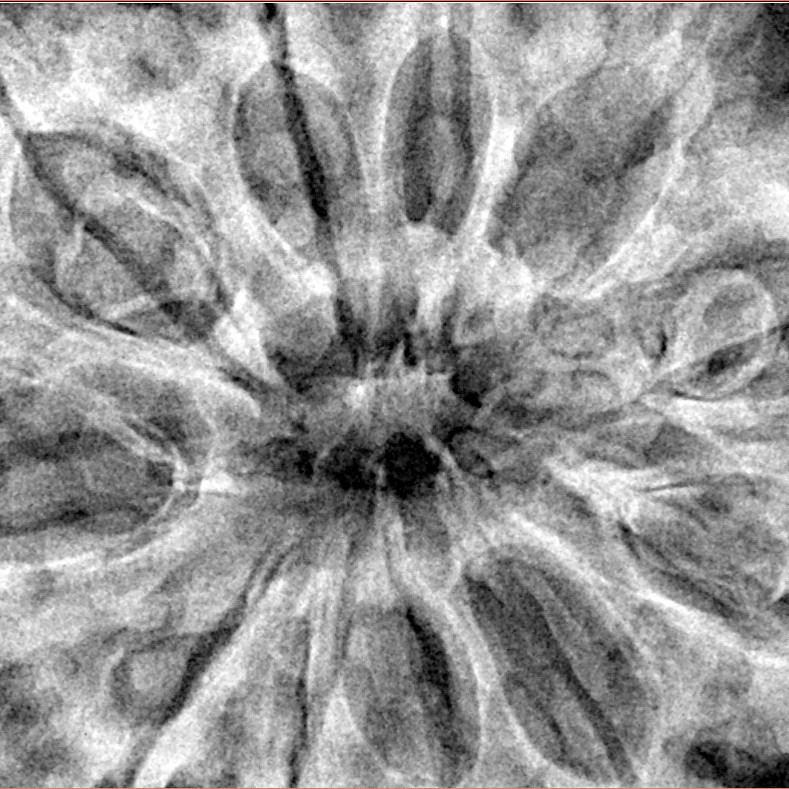 11 Mukhi Rudraksha 38.6mm 9.63gm - Xray