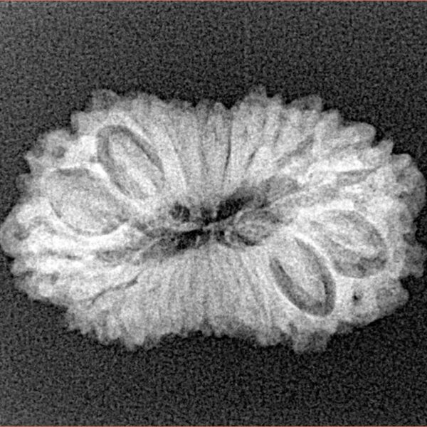 16 Mukhi Rudraksha 25.4mm 2.59gm - Xray