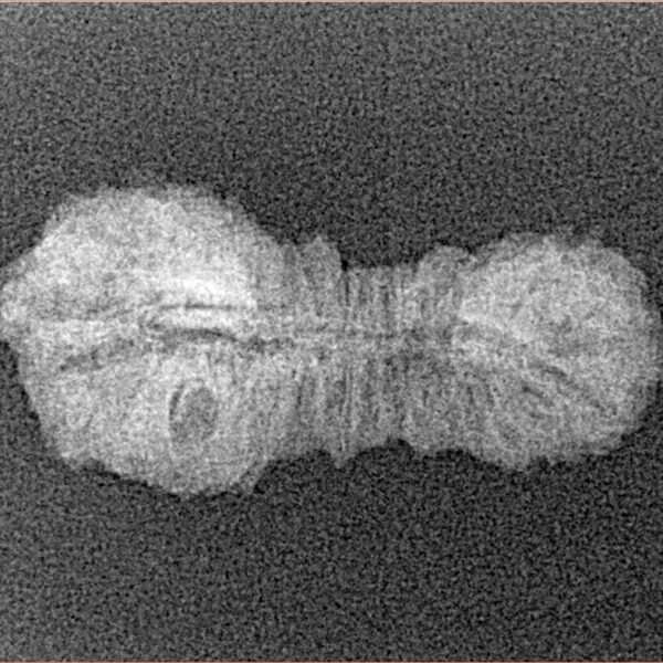 34 Mukhi Rudraksha 26.1mm 1gm - Xray