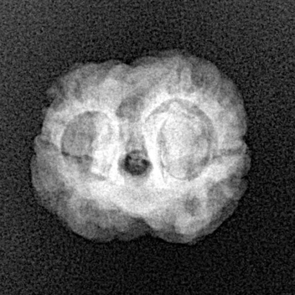 2 Mukhi Rudraksha 21.7mm 1.92gm - Xray