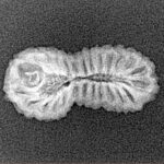 26 Mukhi Rudraksha 22.2mm 1.14gm - Xray