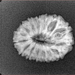 15 Mukhi Rudraksha 20.9mm 1.91gm - Xray