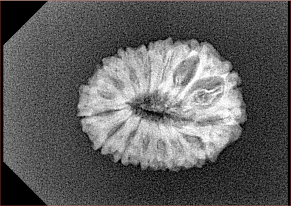 15 Mukhi Rudraksha 20.9mm 1.91gm - Xray