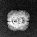 2 Mukhi Rudraksha 23.5mm 1.73gm - Xray