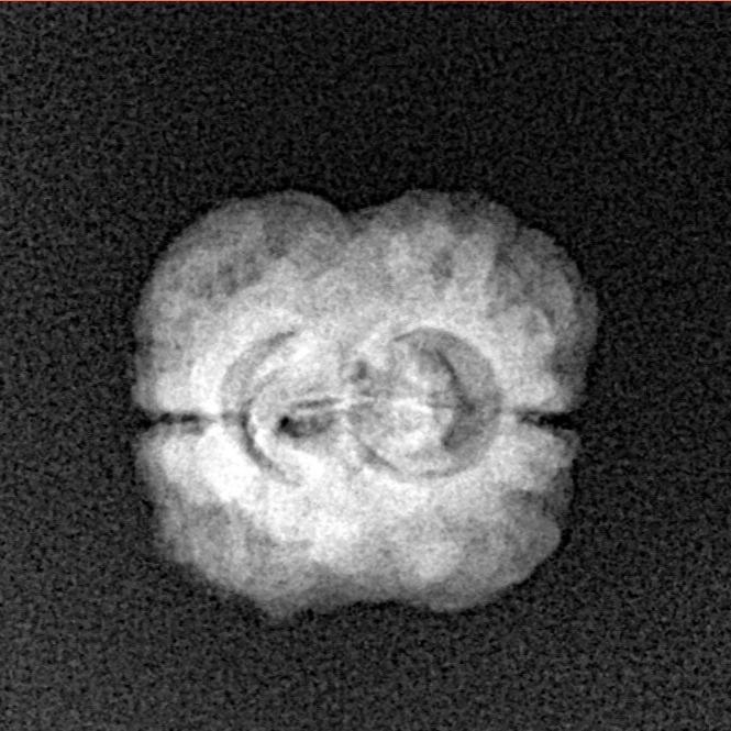 2 Mukhi Rudraksha 23.5mm 1.73gm - Xray