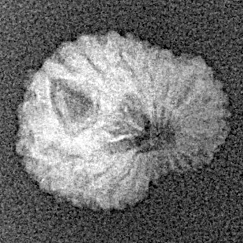 17 Mukhi Rudraksha 14.4mm 0.67gm - Xray