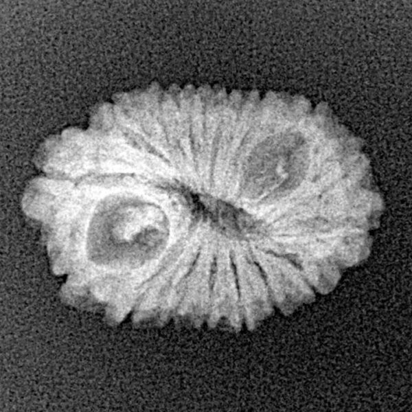 16 Mukhi Rudraksha 20.4mm 1.69gm - Origin: Indonesia - Xray