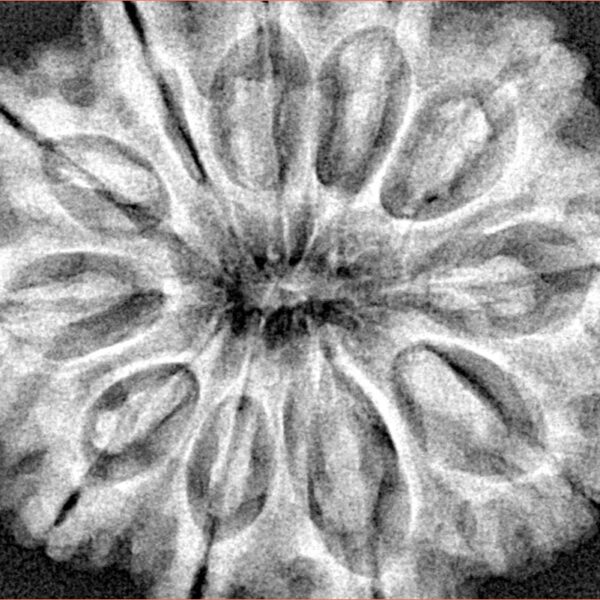 11 Mukhi Rudraksha 32.4mm 7.57gm - Xray