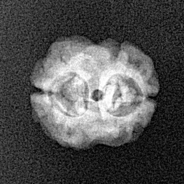 2 Mukhi Rudraksha 17.2mm 1.19gm - Xray