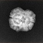 2 Mukhi Rudraksha 24.7mm 2.34gm - Xray