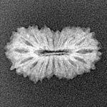 19 Mukhi Rudraksha 19.4mm 1gm - Xray