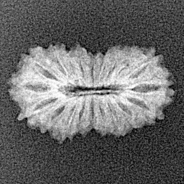 19 Mukhi Rudraksha 19.4mm 1gm - Xray