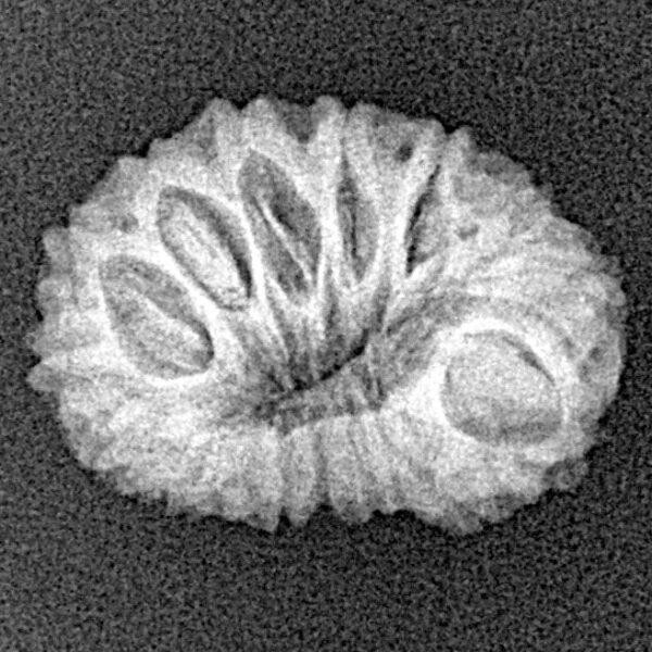 15 Mukhi Rudraksha 19.8mm 1.64gm - Xray