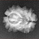 2 Mukhi Rudraksha 16.5mm 1.24gm - Xray