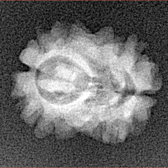 2 Mukhi Rudraksha 16.5mm 1.24gm - Xray