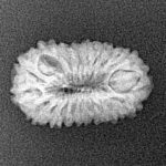 20 Mukhi Rudraksha 20.1mm 1.41gm - Xray