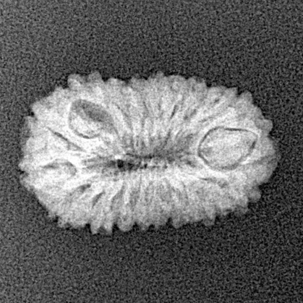 20 Mukhi Rudraksha 20.1mm 1.41gm - Xray