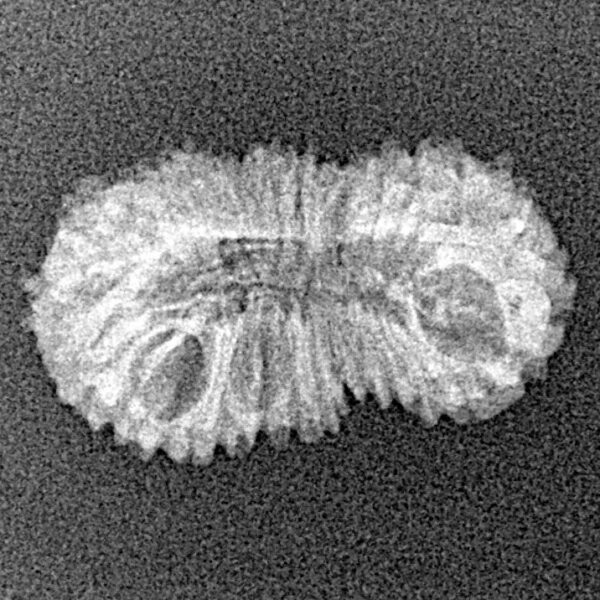 25 Mukhi Rudraksha 21.4mm 1.06gm - Xray