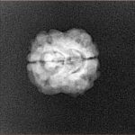 2 Mukhi Rudraksha 20.6mm 1.52gm - Xray