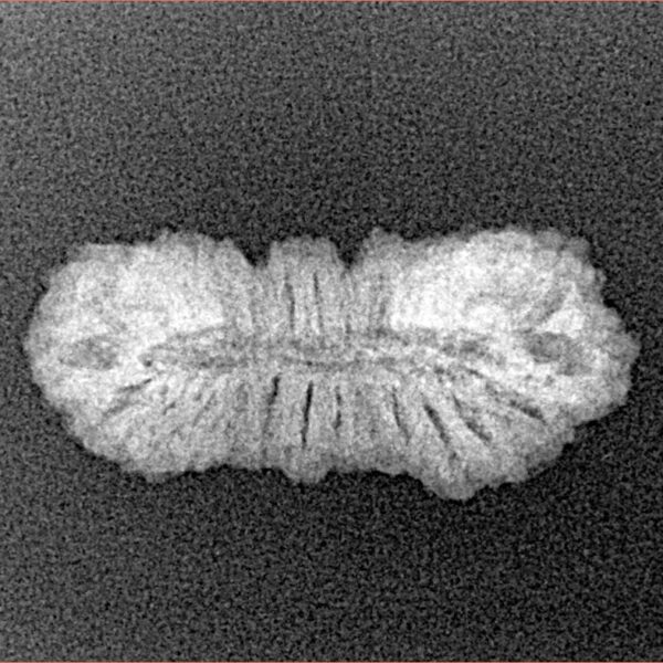 27 Mukhi Rudraksha 23.8mm 1.39gm - Xray