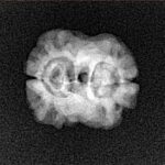2 Mukhi Rudraksha 20.3mm 1.57gm - Xray