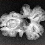 Sawar/Ganesh (2+1) 23.1mm 2.76gm - Xray