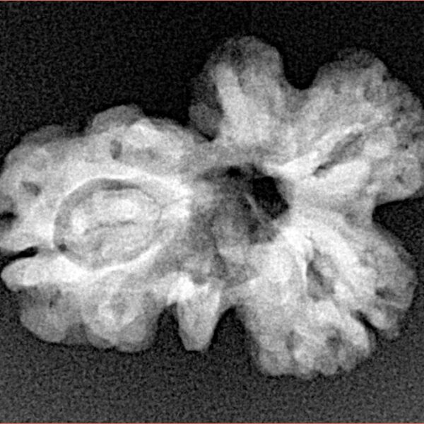 Sawar/Ganesh (2+1) 23.1mm 2.76gm - Xray