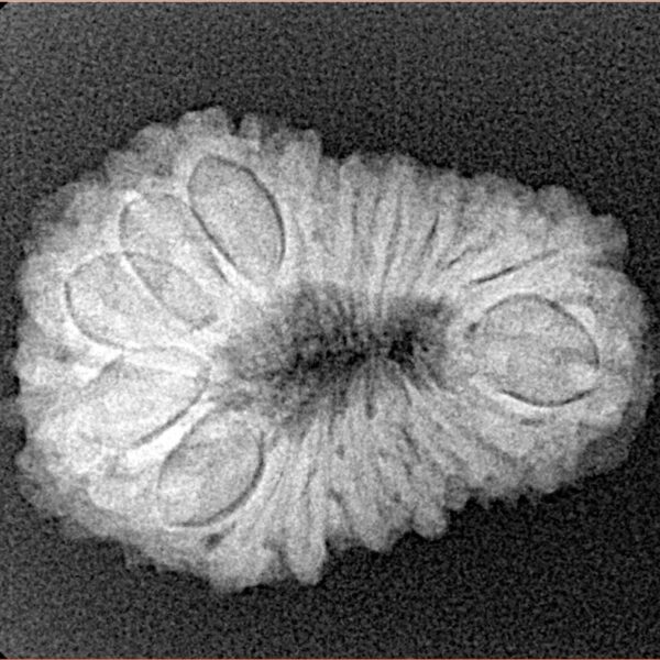 18 Mukhi Rudraksha 25.9mm 2.93gm - Xray