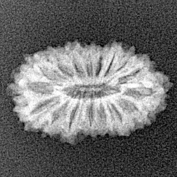 16 Mukhi Rudraksha 19.8mm 1.44gm - Xray