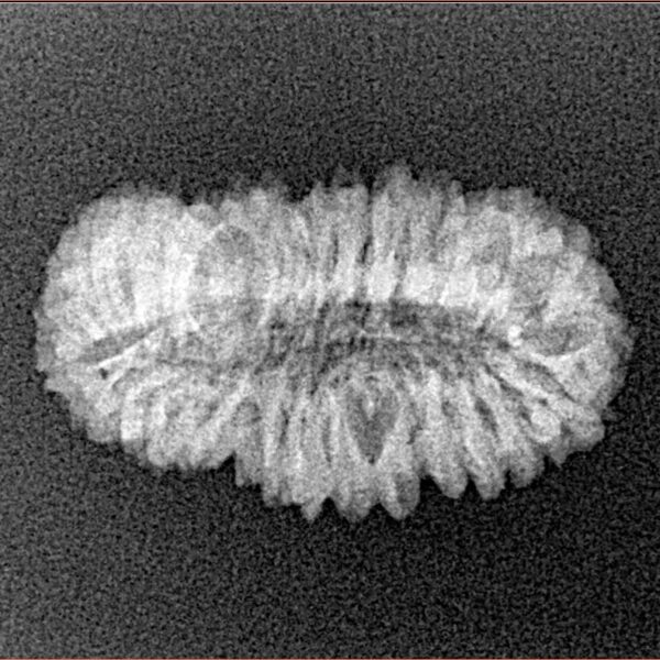 30 Mukhi Rudraksha 23.1mm 1.69gm - Xray