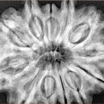 12 Mukhi Rudraksha 33.4mm 8.67gm - Xray