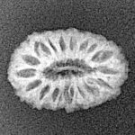 17 Mukhi Rudraksha 16.7mm 0.86gm - Xray